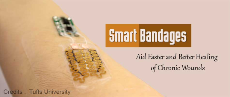 Revolutionary Smart Bandage With Biosensors Monitors Wounds And Heals ...